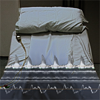 atrial fibrillation patient