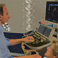 echocardiography