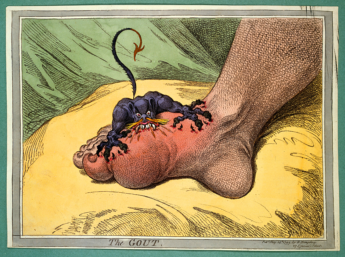 The Gout by Gillray
